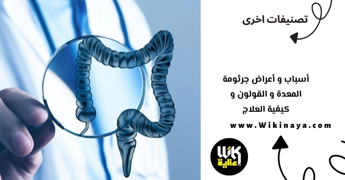 أسباب و أعراض جرثومة المعدة و القولون و كيفية العلاج