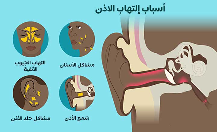 أسباب إلتهاب الاذن