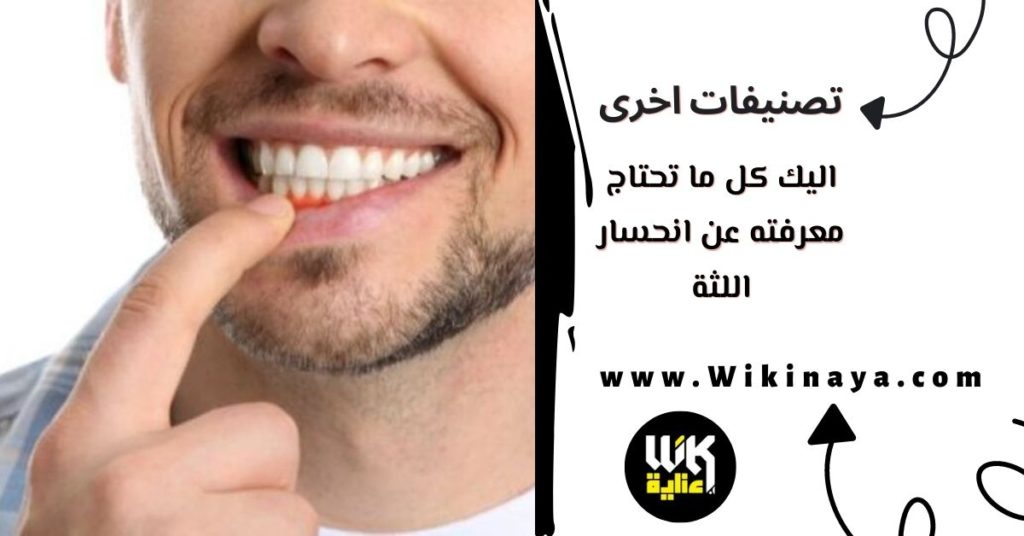 اليك كل ما تحتاج معرفته عن انحسار اللثة