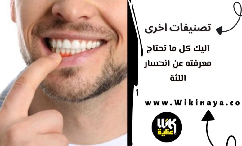 اليك كل ما تحتاج معرفته عن انحسار اللثة