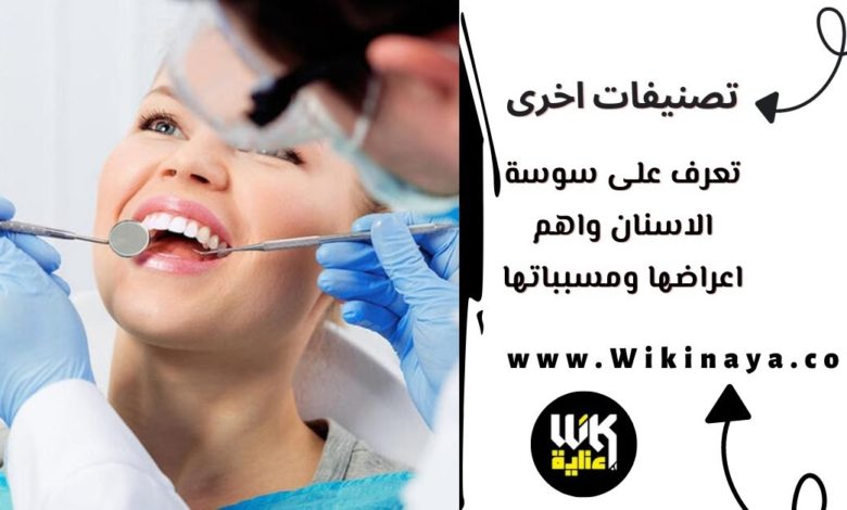 تعرف على سوسة الاسنان واهم اعراضها ومسبباتها