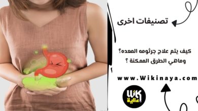 كيف يتم علاج جرثومه المعده؟وماهي الطرق الممكنة ؟