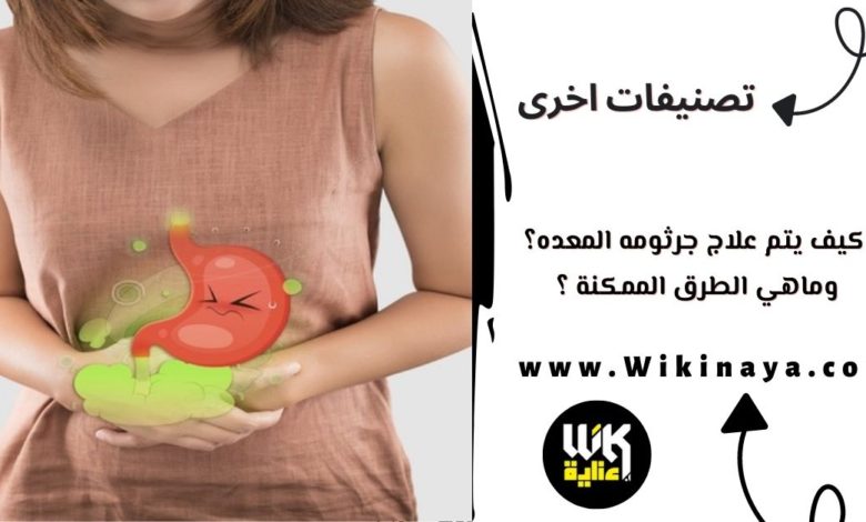 كيف يتم علاج جرثومه المعده؟وماهي الطرق الممكنة ؟