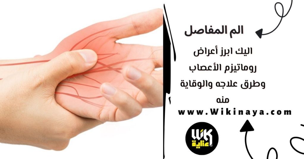 اليك ابرز أعراض روماتيزم الأعصاب وطرق علاجه والوقاية منه