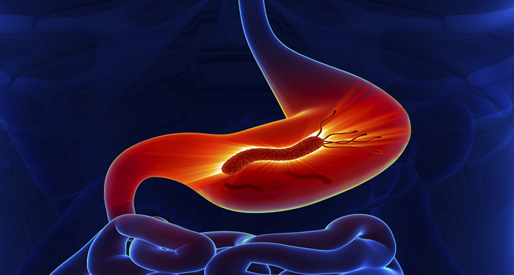 سبب جرثومة المعدة وطرق العلاج والوقاية الممكنة 