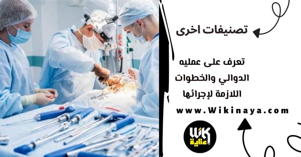 تعرف على عمليه الدوالي والخطوات اللازمة لإجرائها