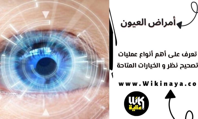 تعرف على أهم أنواع عمليات تصحيح نظر و الخيارات المتاحة