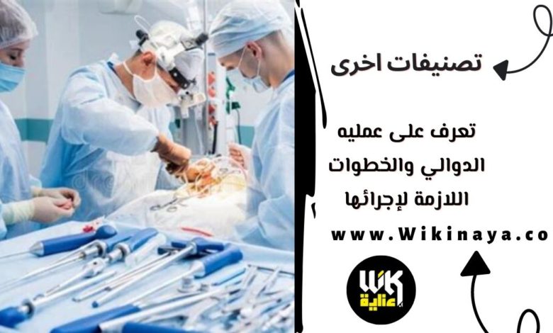 تعرف على عمليه الدوالي والخطوات اللازمة لإجرائها