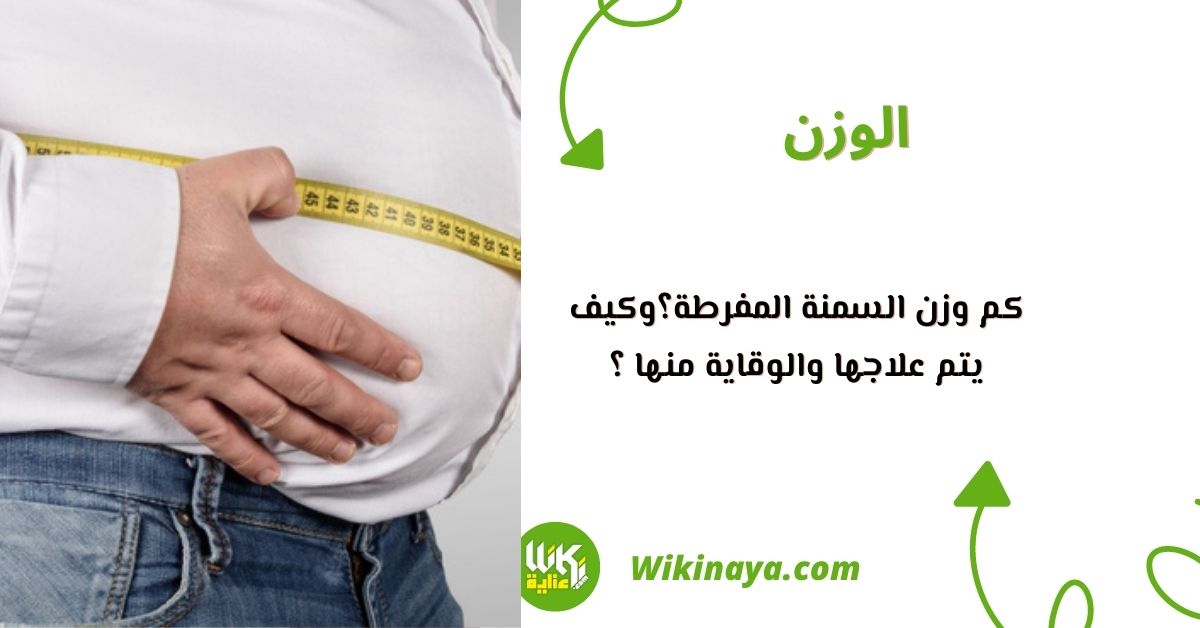 كم وزن السمنة المفرطة؟وكيف يتم علاجها والوقاية منها ؟