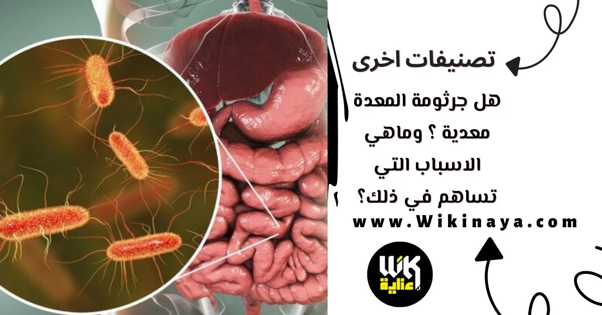 هل جرثومة المعدة معدية ؟ وماهي الاسباب التي تساهم في ذلك؟