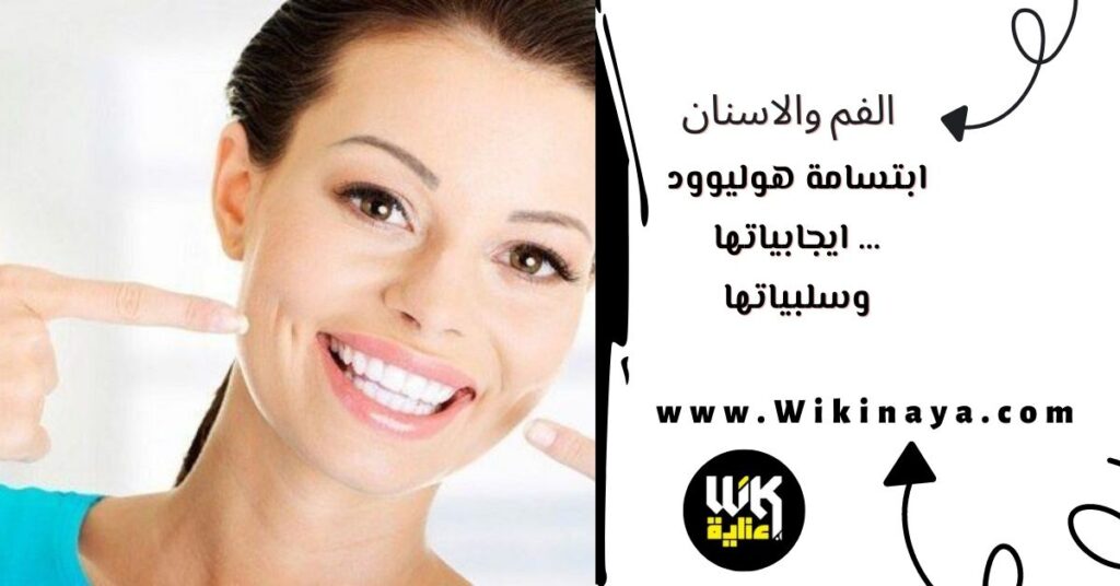 ابتسامة هوليوود … ايجابياتها وسلبياتها