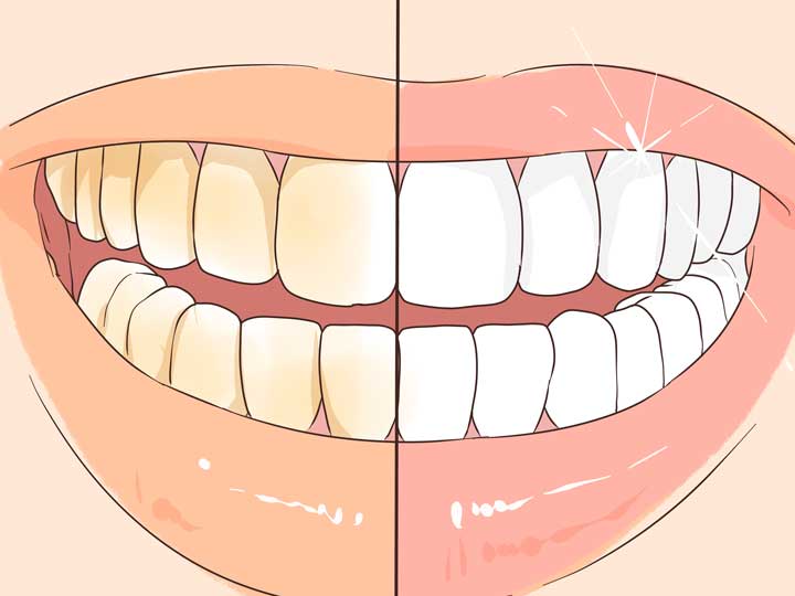 طرق تبييض الاسنان ال8 سهلة الاستخدام