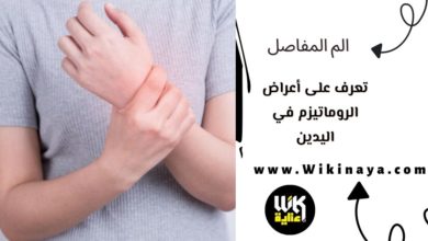 تعرف على أعراض الروماتيزم في اليدين