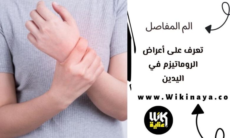 تعرف على أعراض الروماتيزم في اليدين