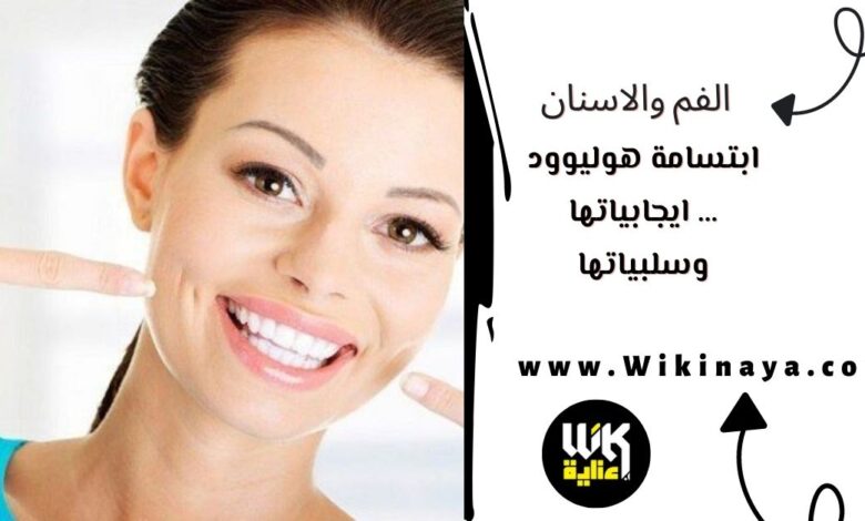 ابتسامة هوليوود … ايجابياتها وسلبياتها