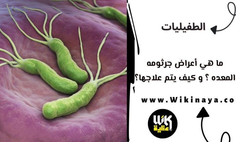 ما هي أعراض جرثومه المعده ؟ و كيف يتم علاجها؟