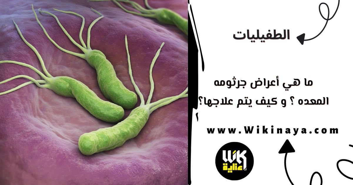 ما هي أعراض جرثومه المعده ؟ و كيف يتم علاجها؟