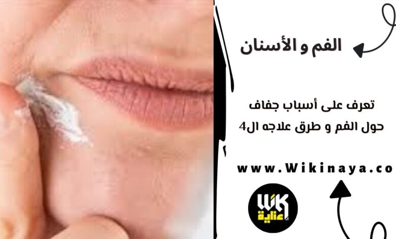 تعرف على أسباب جفاف حول الفم و طرق علاجه ال4