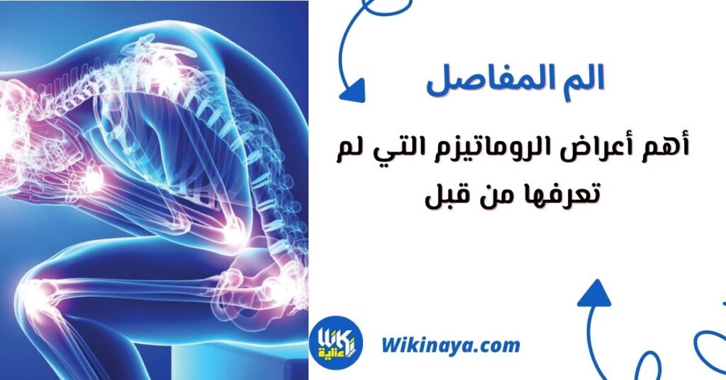 أعراض الروماتيزم