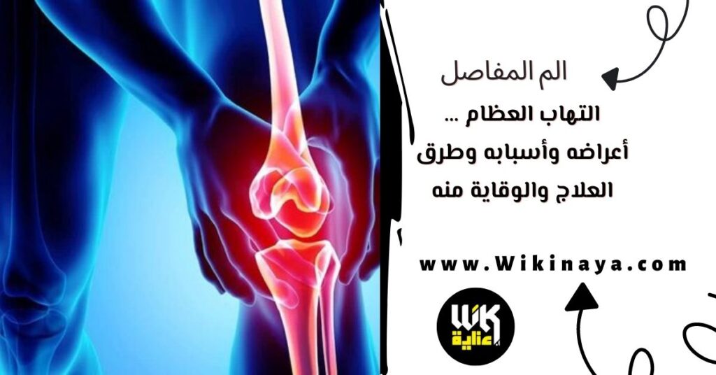 التهاب العظام … أعراضه وأسبابه وطرق العلاج والوقاية منه