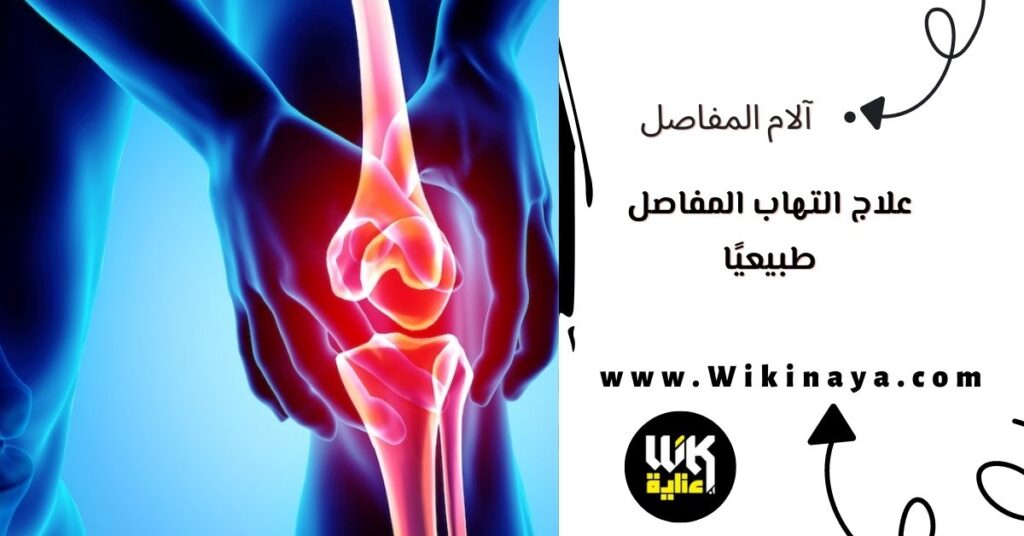 علاج التهاب المفاصل طبيعيًا