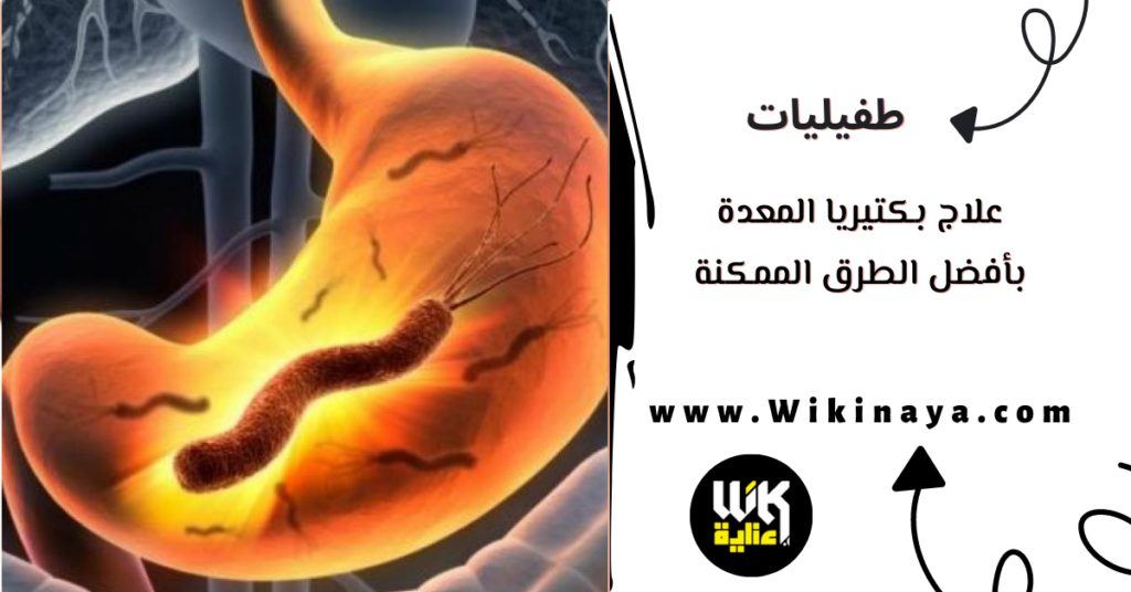 علاج بكتيريا المعدة