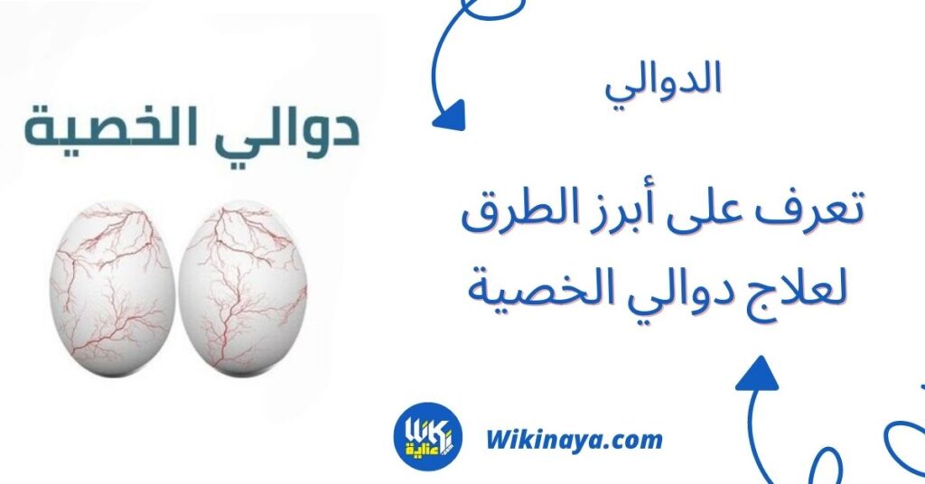 علاج دوالي الخصية