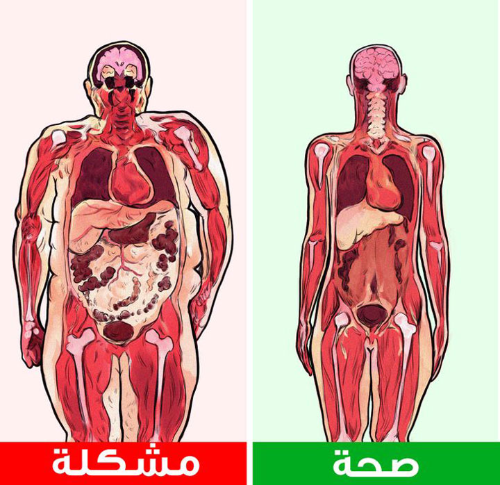 مخاطر دهون البطن