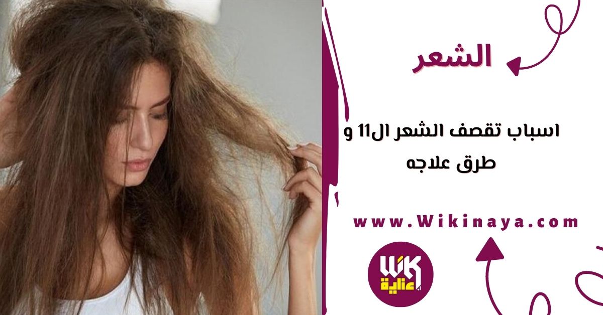 اسباب تقصف الشعر ال11 و طرق علاجه