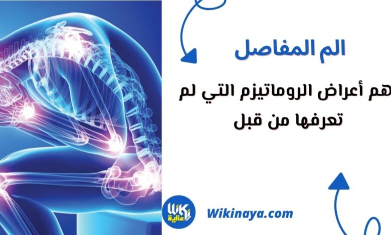 أعراض الروماتيزم