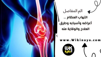 التهاب العظام … أعراضه وأسبابه وطرق العلاج والوقاية منه