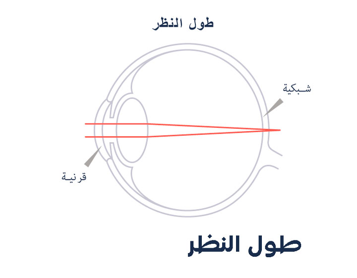 قياس النظر من 10