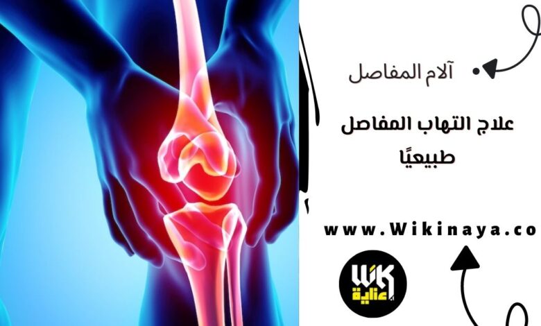 علاج التهاب المفاصل طبيعيًا