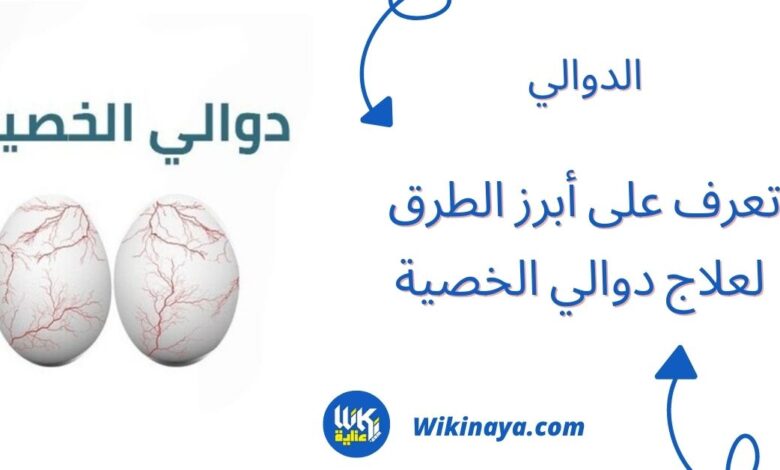 علاج دوالي الخصية