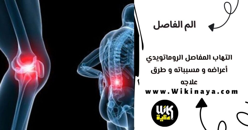 التهاب المفاصل الروماتويدي أعراضه و مسبباته و طرق علاجه