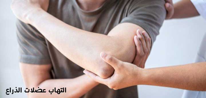 التهاب عضلات الذراع