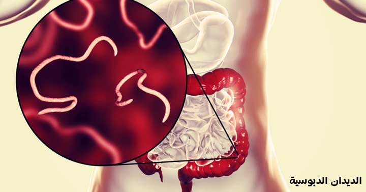 الديدان الدبوسية