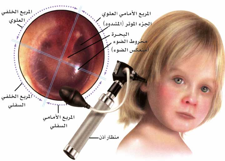 الأعراض المتعلقة بالتهاب الاذن لدى الأطفال