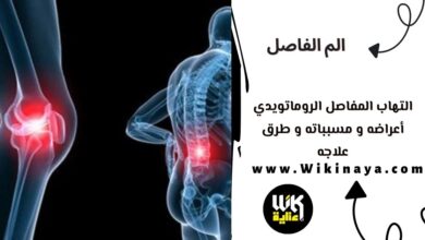 التهاب المفاصل الروماتويدي أعراضه و مسبباته و طرق علاجه