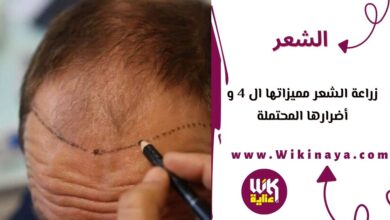 زراعة الشعر مميزاتها ال 4 و أضرارها المحتملة