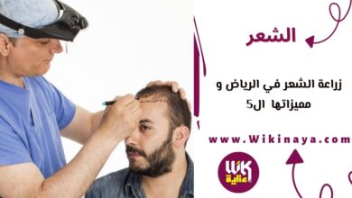 زراعة الشعر في الرياض و مميزاتها ال5