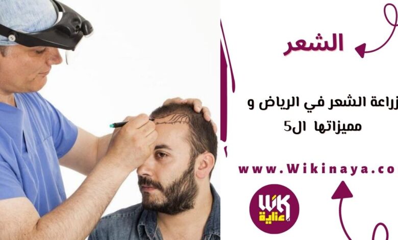 زراعة الشعر في الرياض و مميزاتها ال5