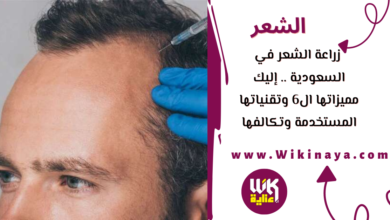 زراعة الشعر في السعودية