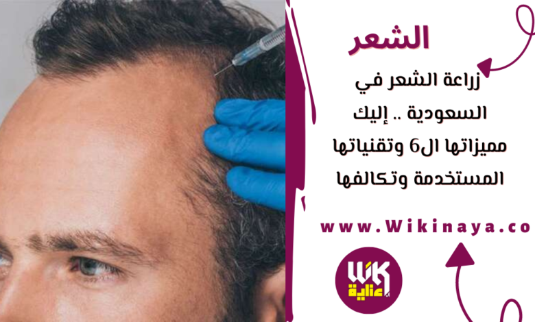 زراعة الشعر في السعودية