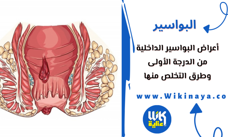 أعراض البواسير الداخلية من الدرجة الأولى