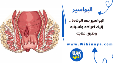 البواسير بعد الولادة