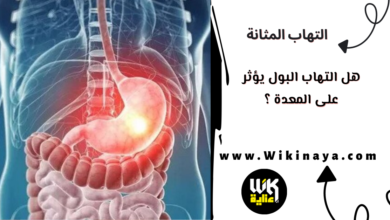 هل التهاب البول يؤثر على المعدة ؟