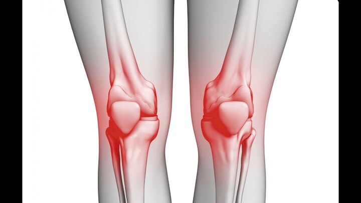 الم المفاصل اعراضه ال 8 ومسبباته وطرق العلاج والوقاية منه