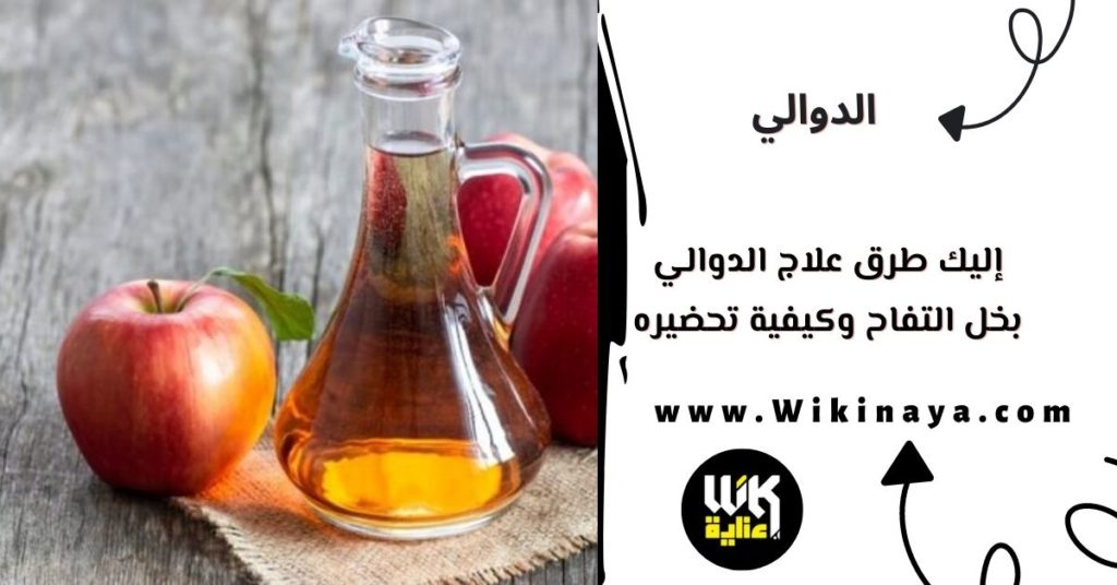 إليك طرق علاج الدوالي بخل التفاح وكيفية تحضيره