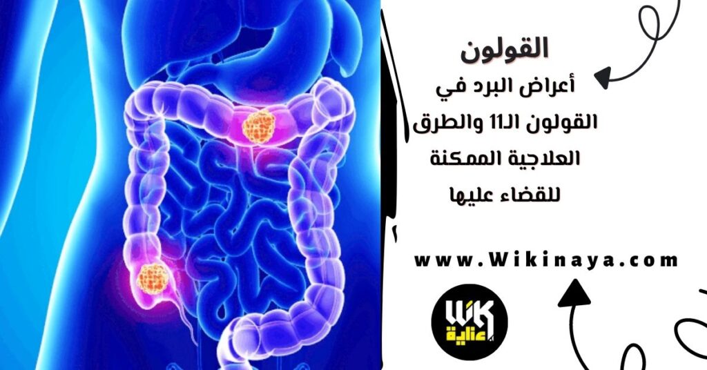 أعراض البرد في القولون الـ11 والطرق العلاجية الممكنة للقضاء عليها